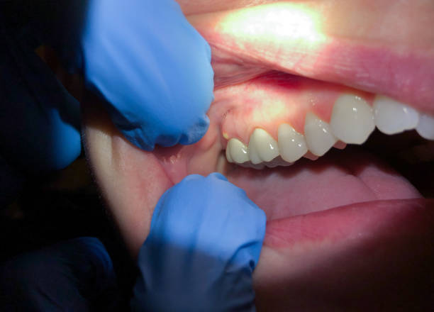 Best After-Hours Emergency Dentist in Berryville, AR