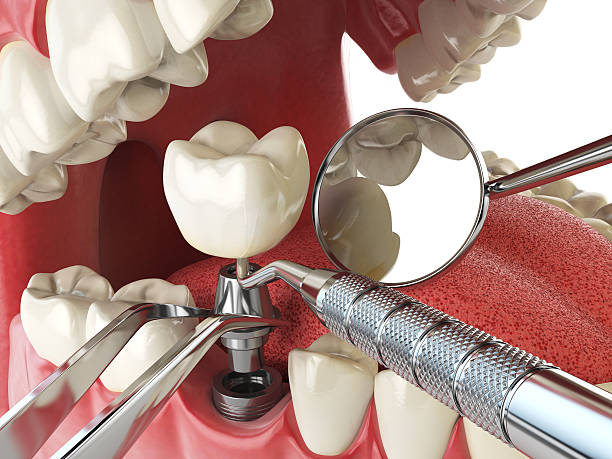 Best Emergency Root Canal Treatment in Berryville, AR